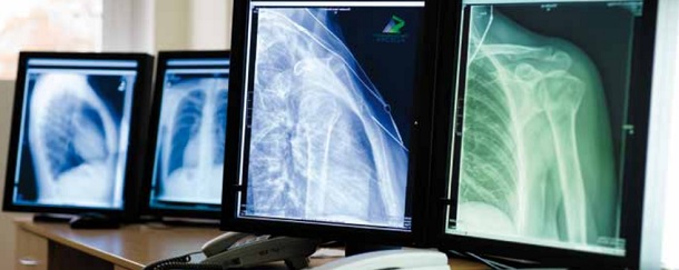 Diagnostica per immagini